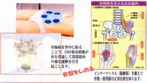 骨盤矯正の必要性